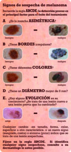 Imagen del Sistema ABCDE Melanoma