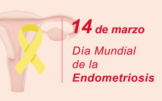 Endometriosis: qué es, síntomas y causas