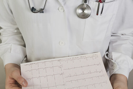 Ecocardiograma vs electrocardiograma: diferencias y requisitos