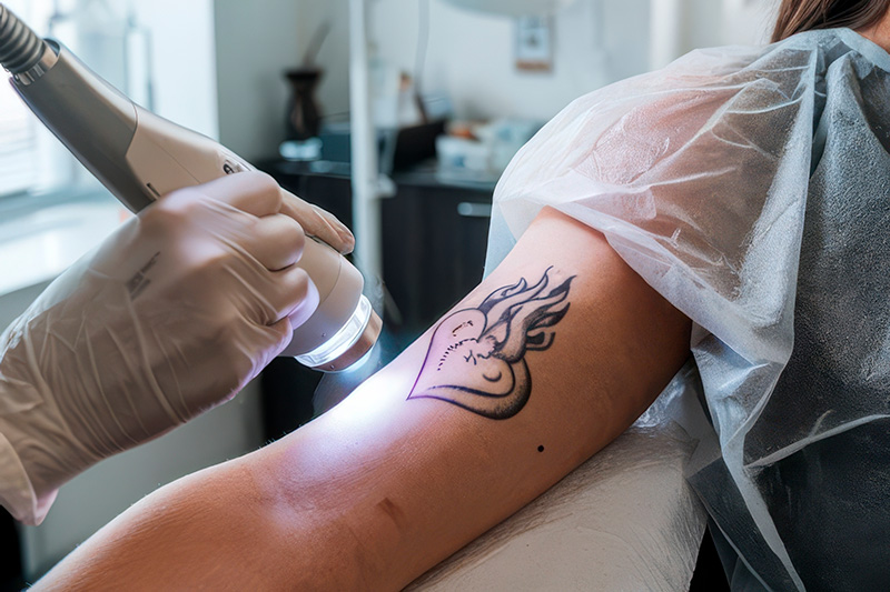 Tatuajes y salud de la piel: lo que debes saber antes de decidirte