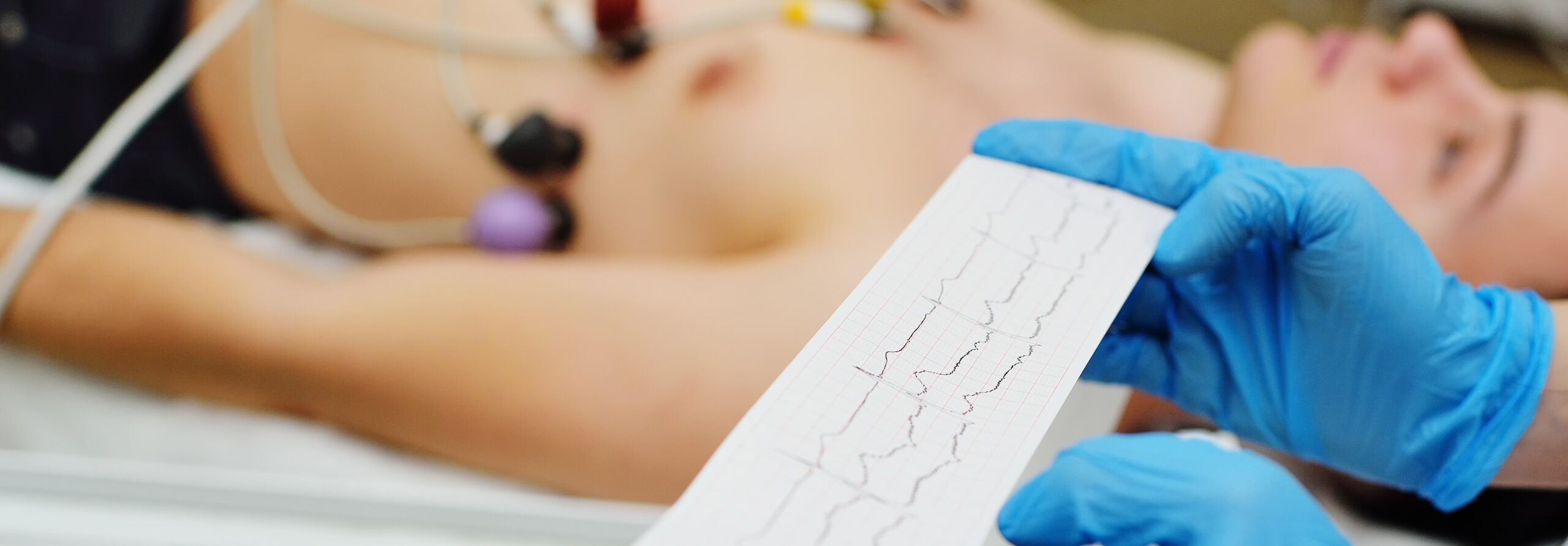 Electrocardiograma o ECG