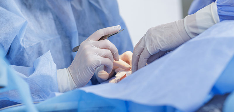 Cirugía de párpados blefaroplastia