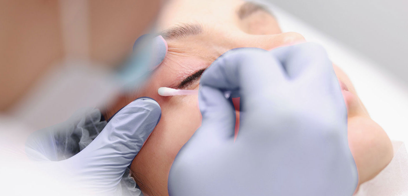 Valoración médica previa y diagnóstico personalizado para blefaroplastia