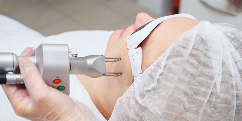 Dermatología estética en Vigo
