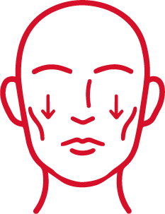 Cirugía de rejuvenecimiento facial para descenso de mejillas