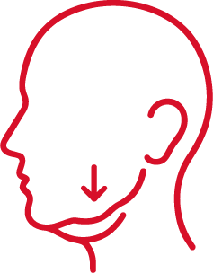 Cirugía de rejuvenecimiento facial para descolgamiento del óvalo facial