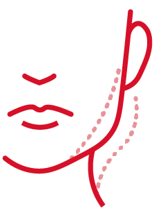 Cirugía de rejuvenecimiento facial para pérdida de definición mandibular