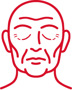Cirugía de rejuvenecimiento facial para signos avanzados de envejecimiento facial