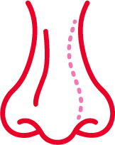 Rinoplastia para asimetrías nasales