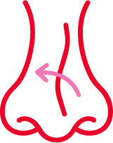 Rinoplastia para desviación del tabique nasal