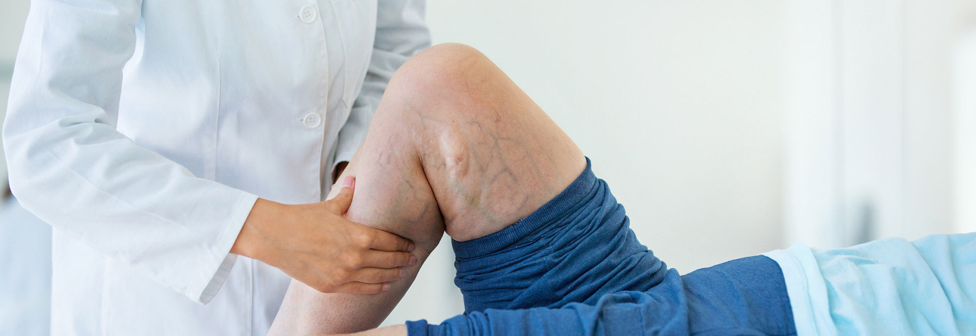 Tratamiento médico de varices en La Eliana y Valencia