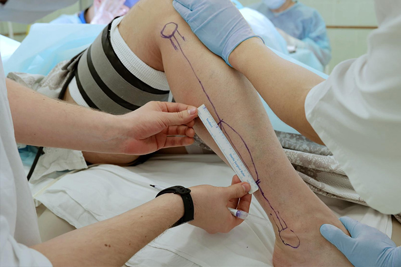 Cirugía vascular