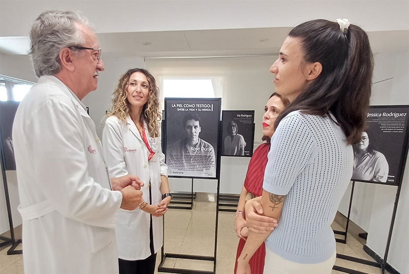 Ribera Juan Cardona acoge la muestra itinerante de Asotrame, “La piel como testigo entre la vida y su herida”