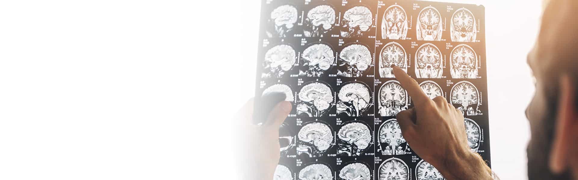 Neurología