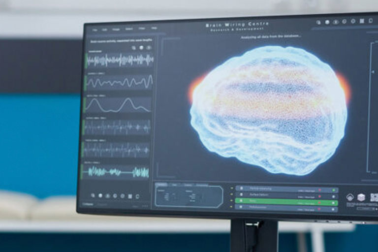 Neurofisiología en Lugo