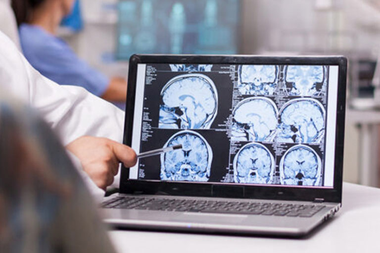 Neurología en Lugo