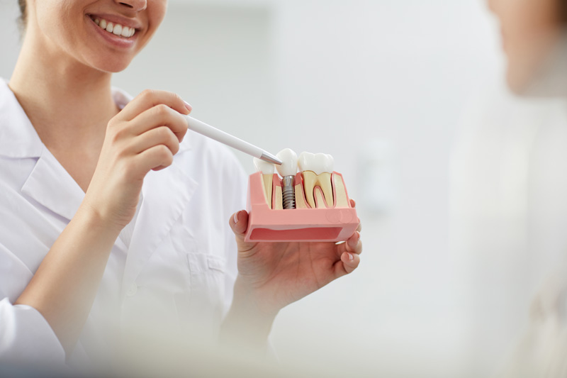 sonriendo dentista explicando implantacion dientes