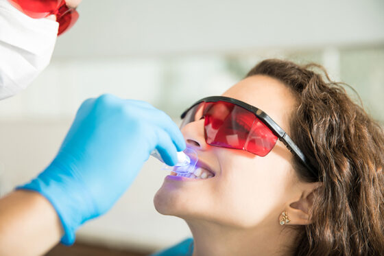 Cuánto dura un blanqueamiento dental