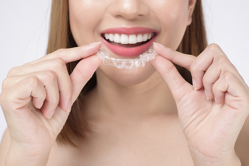 refinamiento dental