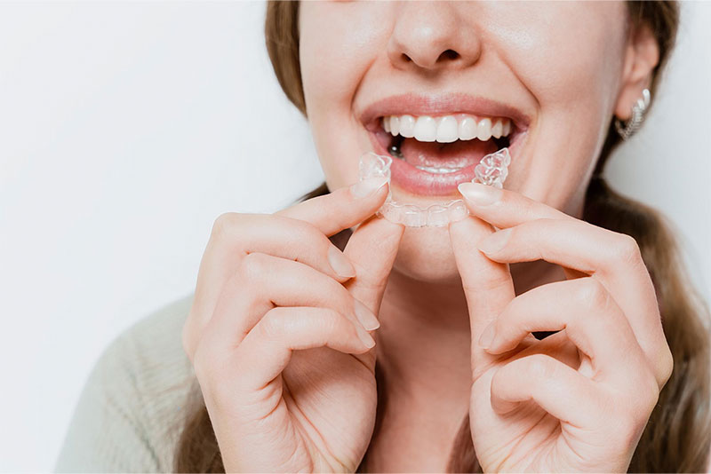 Combinar ortodoncia invisible con implantes dentales