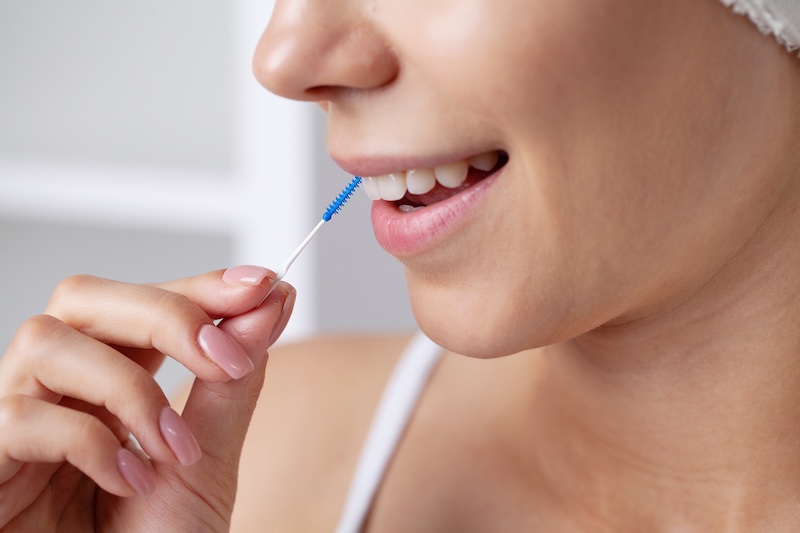 stripping dental