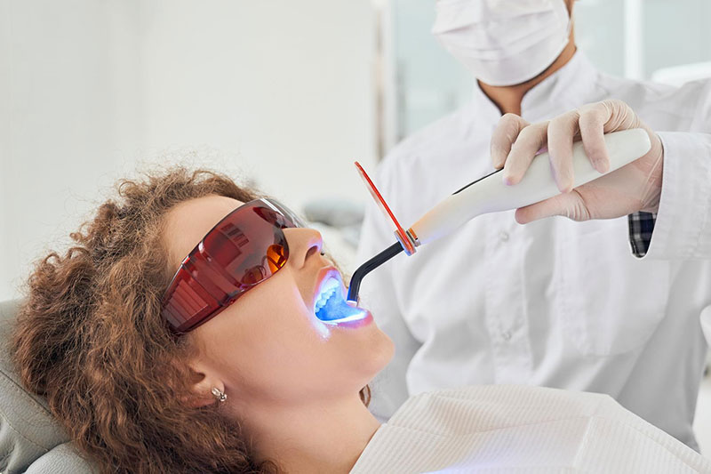 Blanqueamiento dental vs. limpieza avanzada