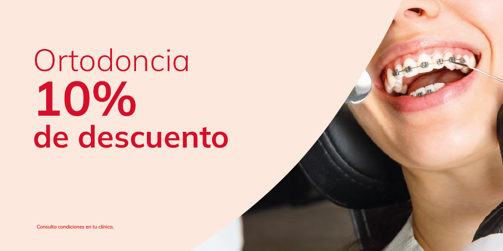 Promo: Ortodoncia 10% de descuento