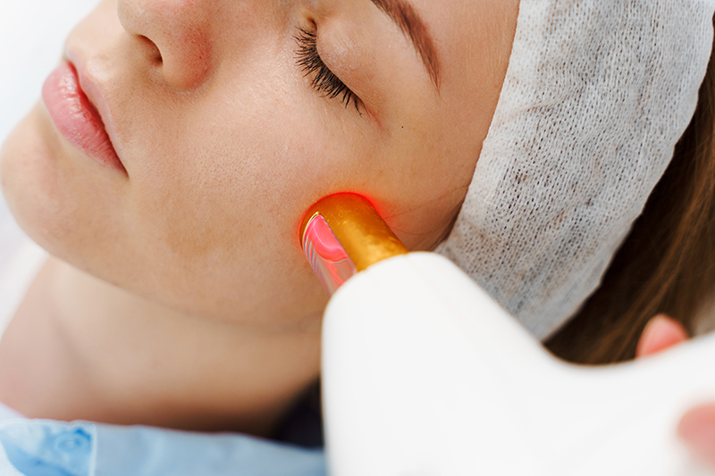 Resurfacing: Rejuvenecimiento facial con láser CO2