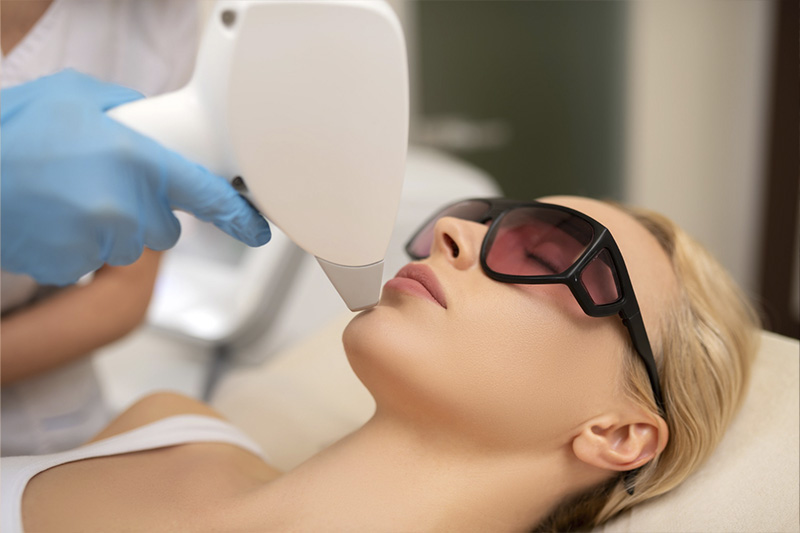 IPL facial, para qué sirve y resultados obtenidos
