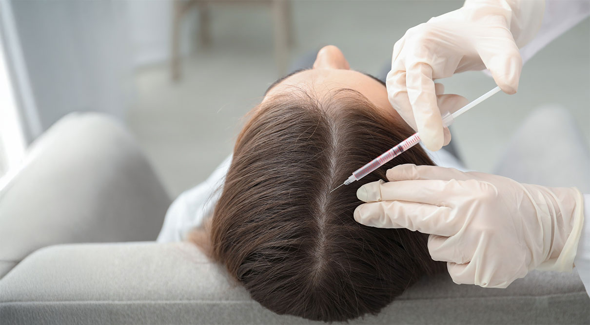 Medicina estética capilar, tratamientos y transplante capilar