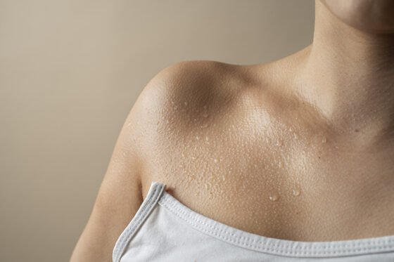 Hiperhidrosis o sudoración excesiva: qué es, causas y tratamientos disponibles