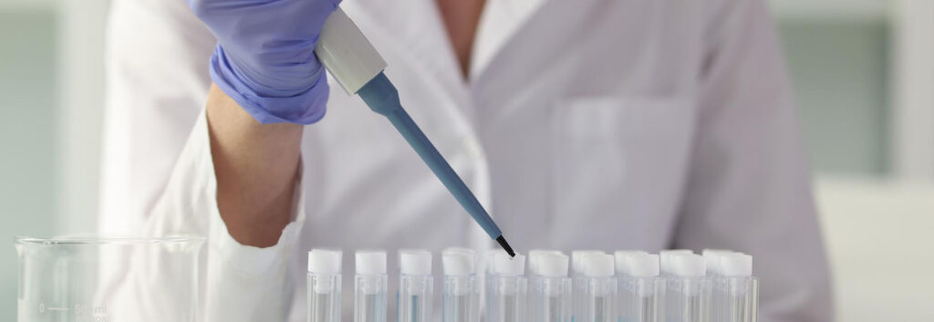 Test de alergias inmunoglobulina