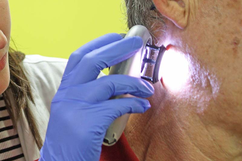 Una dermatóloga de Ribera revisa manchas y lunares de un paciente2