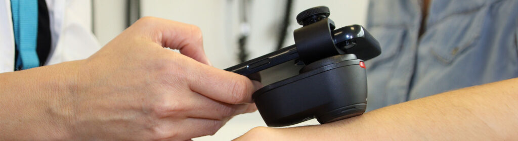 Teledermatología, caso de éxito